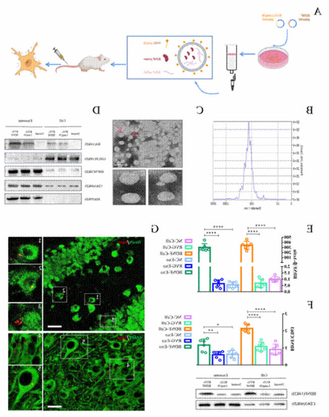 程勇教授团队在工程化外泌体技术结合基因治疗缓解抑郁症方面取得新进展